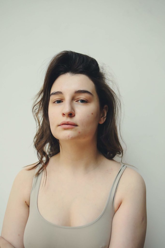 Hormonal Acne - Northwest Dermatology