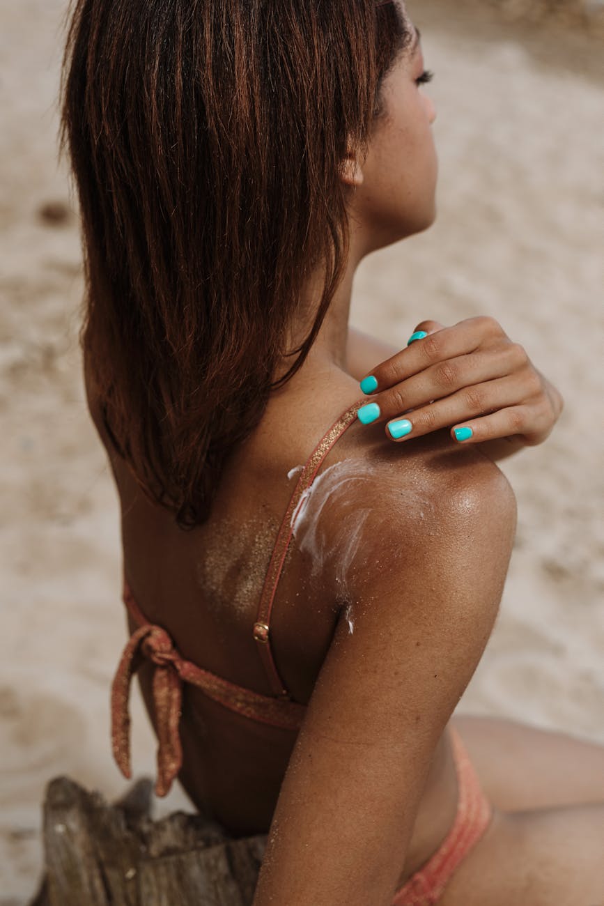 How to Treat & Heal Sunburn